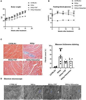 Tangshen Formula Improves Diabetes-Associated Myocardial Fibrosis by Inhibiting TGF-β/Smads and Wnt/β-Catenin Pathways